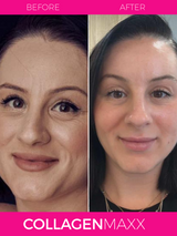 COLLAGEN MAXX