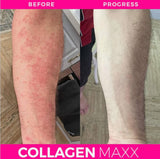 COLLAGEN MAXX