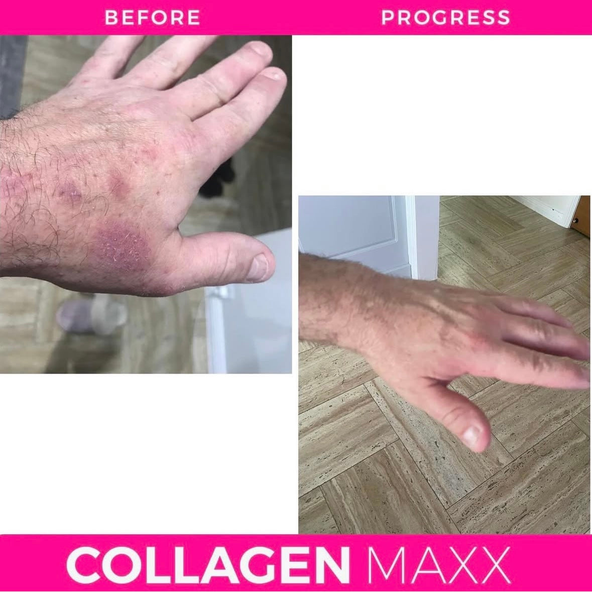 COLLAGEN MAXX