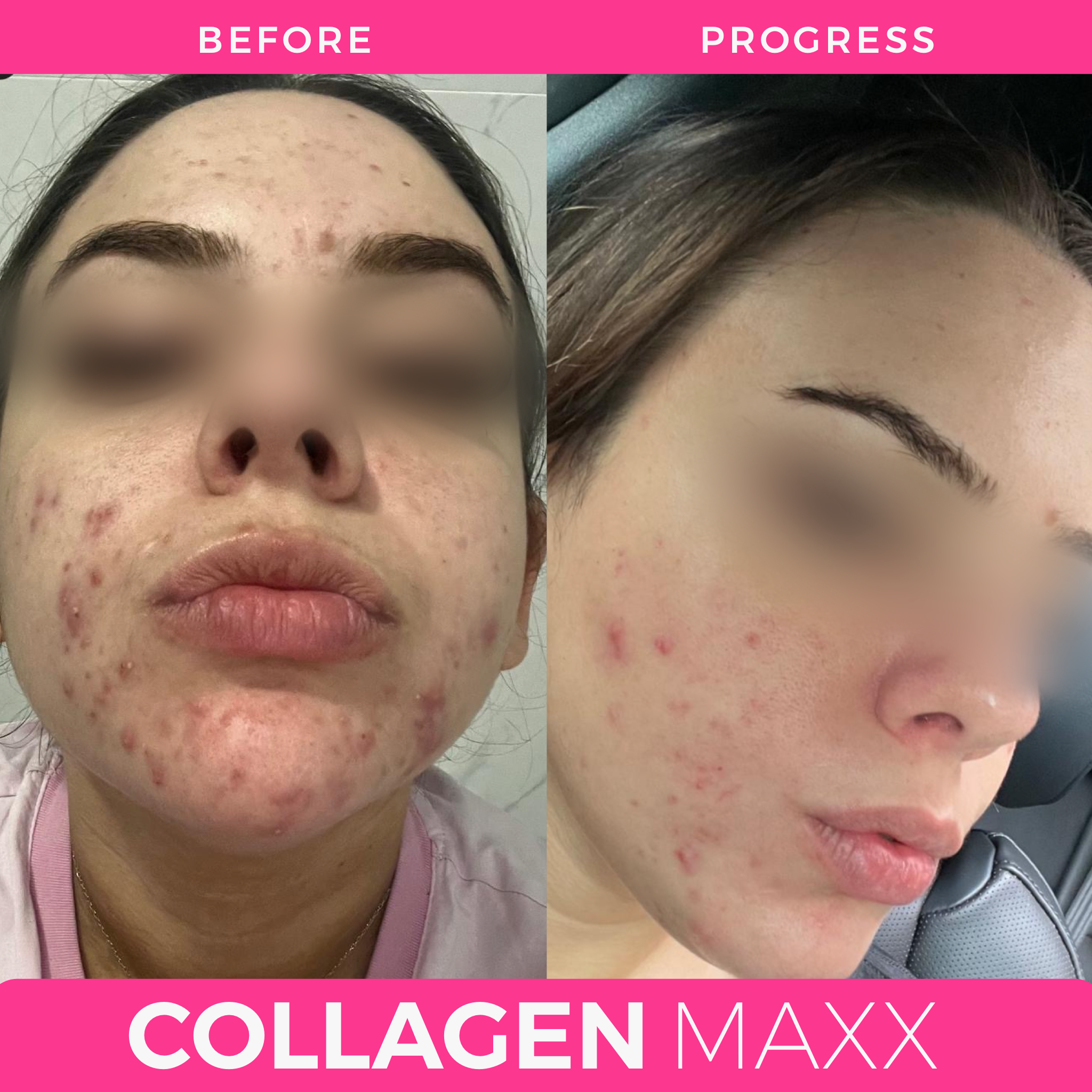 COLLAGEN MAXX